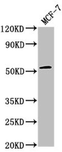 Western Blot. Positive WB detected in: MCF-7 whole cell lysate. All lanes: PPM1J antibody at 1:2000. Secondary. Goat polyclonal to rabbit IgG at 1/50000 dilution. Predicted band size: 55, 34 kDa. Observed band size: 55 kDa.