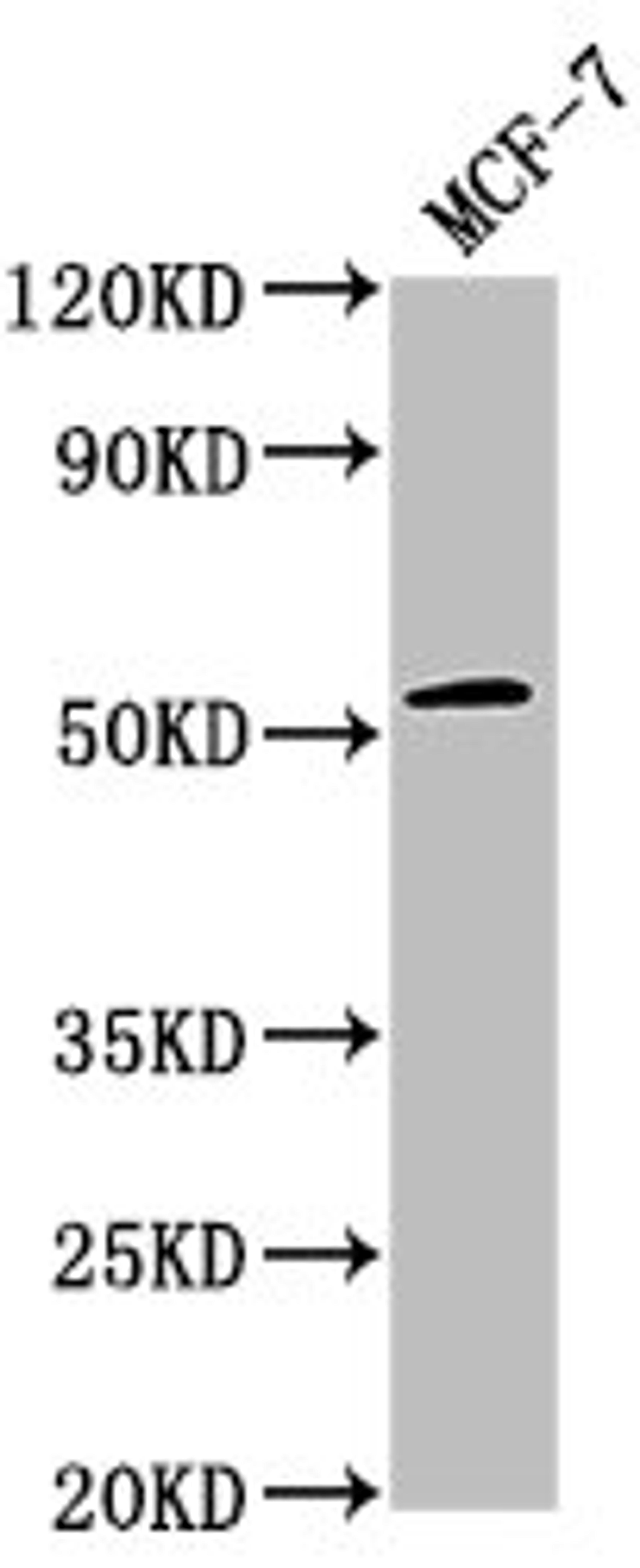 Western Blot. Positive WB detected in: MCF-7 whole cell lysate. All lanes: PPM1J antibody at 1:2000. Secondary. Goat polyclonal to rabbit IgG at 1/50000 dilution. Predicted band size: 55, 34 kDa. Observed band size: 55 kDa.