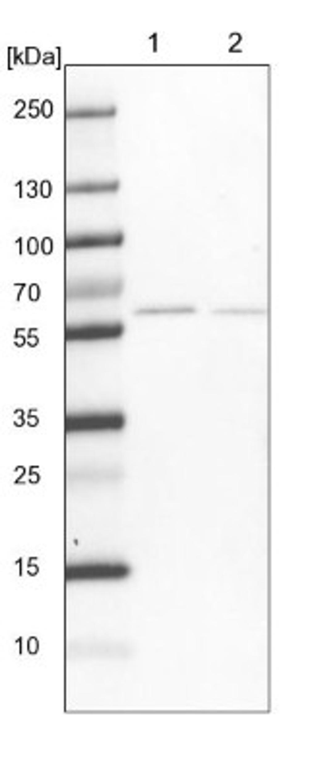 Western Blot: pre-mRNA cleavage factor I (59 kDa subunit) Antibody [NBP1-89868] - Lane 1: NIH-3T3 cell lysate (Mouse embryonic fibroblast cells)<br/>Lane 2: NBT-II cell lysate (Rat Wistar bladder tumour cells)