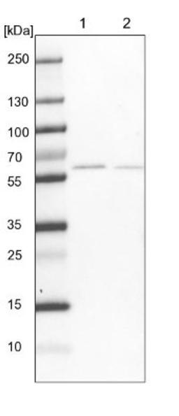 Western Blot: pre-mRNA cleavage factor I (59 kDa subunit) Antibody [NBP1-89868] - Lane 1: NIH-3T3 cell lysate (Mouse embryonic fibroblast cells)<br/>Lane 2: NBT-II cell lysate (Rat Wistar bladder tumour cells)