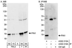 Detection of human and mouse PIN1 by western blot (h&m) and immunoprecipitation (h).