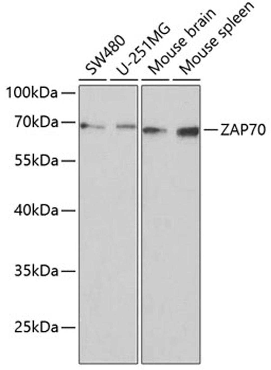 Western blot - ZAP70 Antibody (A2195)