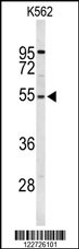 Western blot analysis of RPS6KB2 Antibody in K562 cell line lysates (35ug/lane)