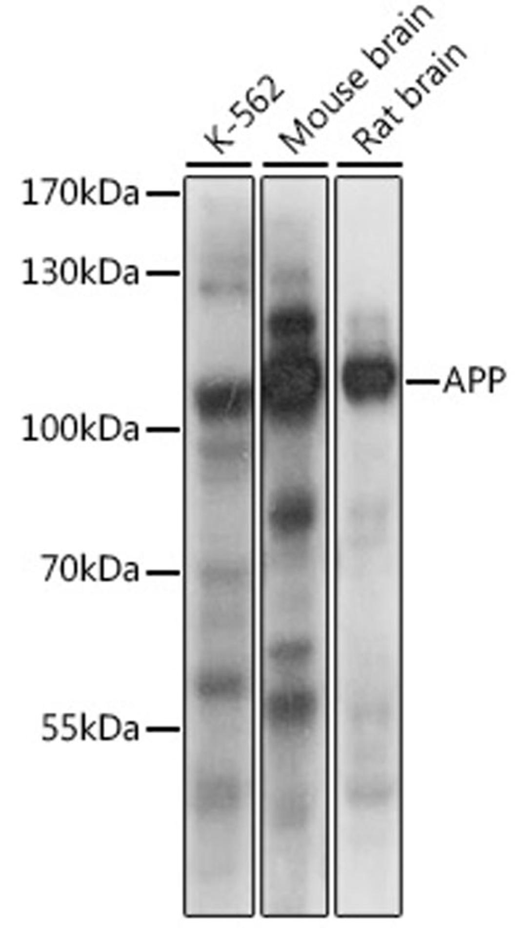 Western blot - APP antibody (A16265)