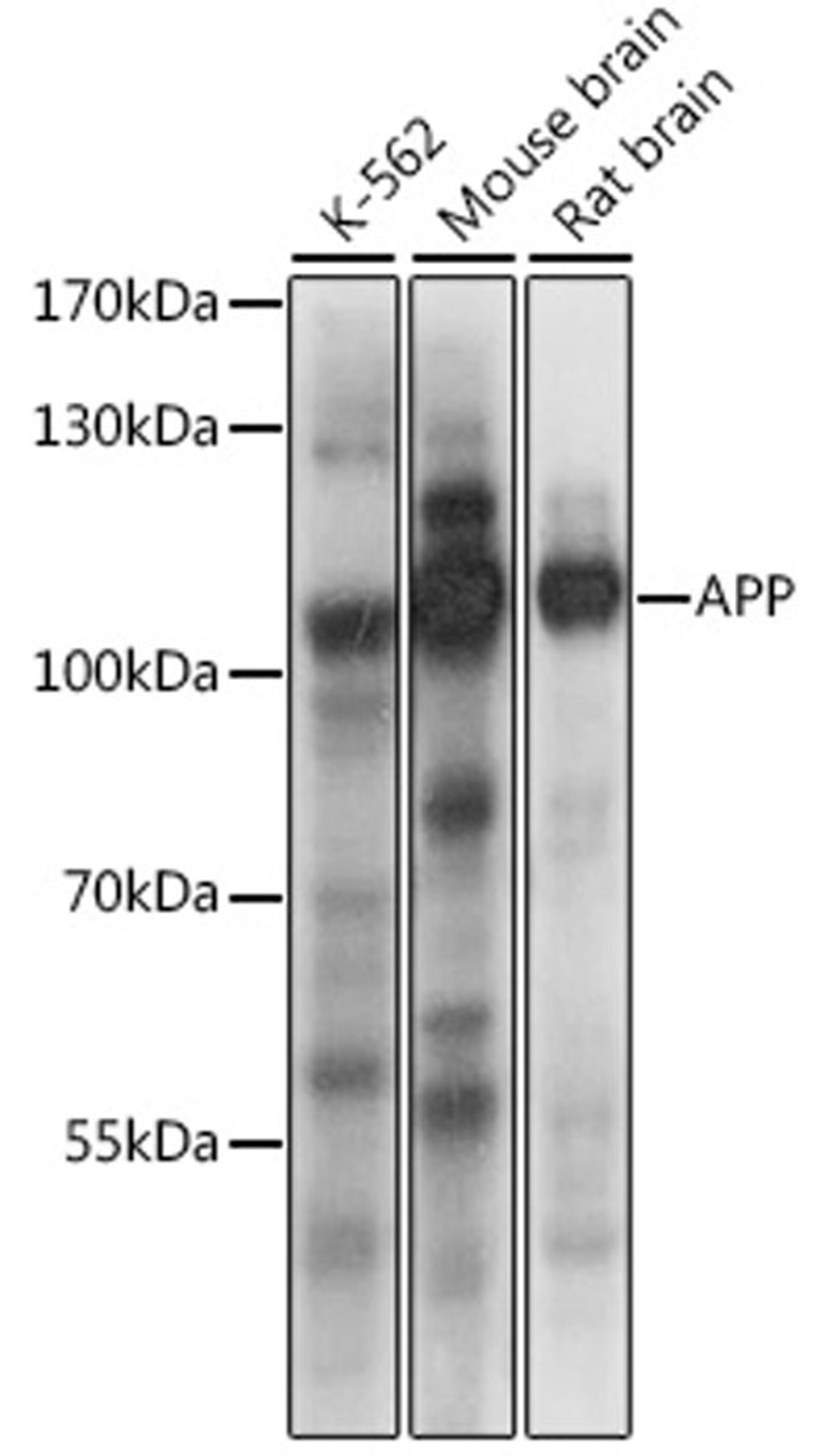 Western blot - APP antibody (A16265)