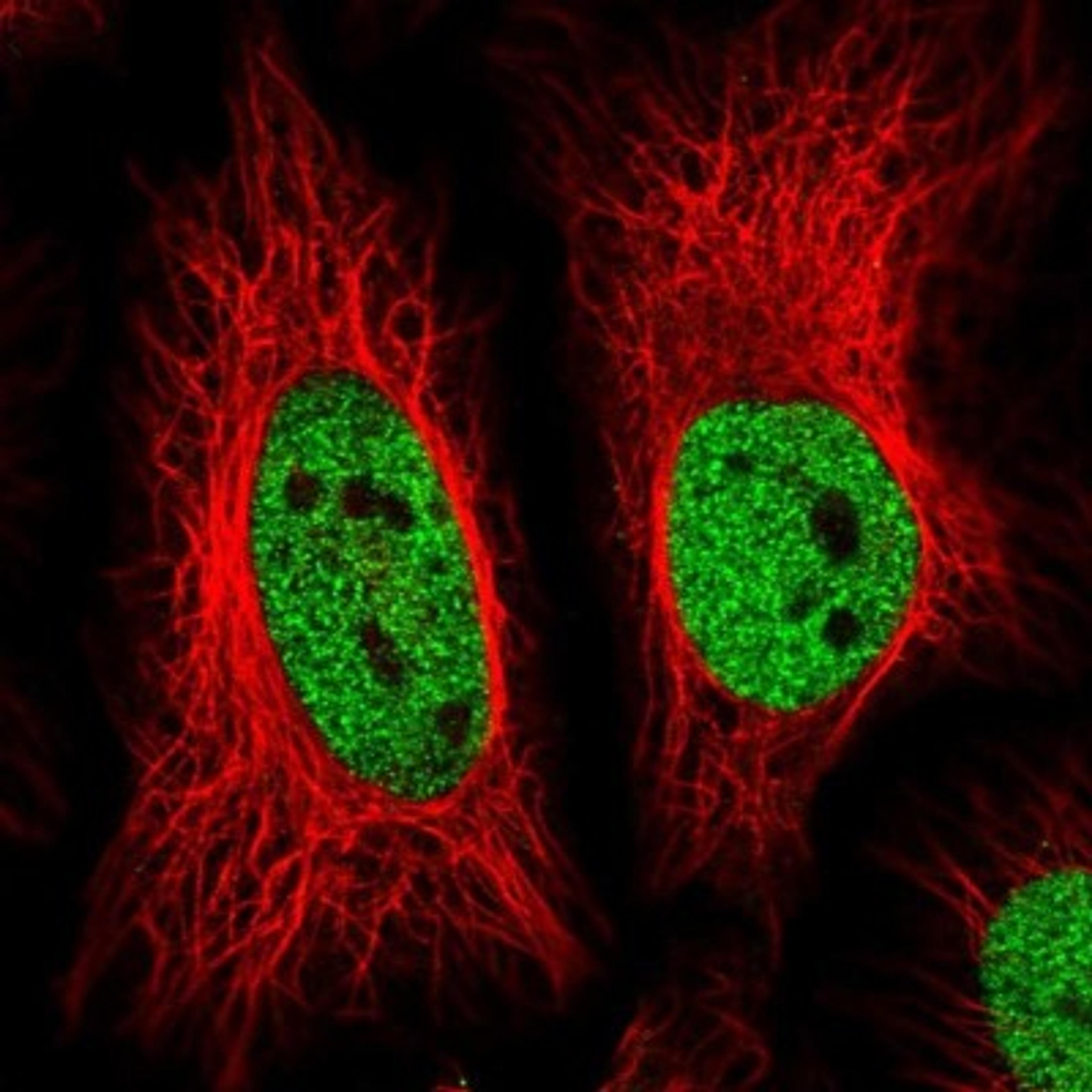 Immunocytochemistry/Immunofluorescence: ZBTB25 Antibody [NBP2-31583] - Staining of human cell line HeLa shows positivity in nucleus but not nucleoli.