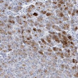 Immunohistochemistry-Paraffin: Chymotrypsin-like protease Antibody [NBP2-33973] - Immunohistochemical staining of human pancreas shows strong cytoplasmic positivity in a subset of cells.