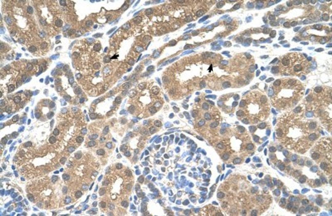 Immunohistochemistry-Paraffin: MCT3/SLC16A8 Antibody [NBP1-59885] - Human kidney Tissue, antibody concentration 4-8ug/ml. Cells with positive label: renal corpuscle cells (indicated with arrows) 400X magnification.