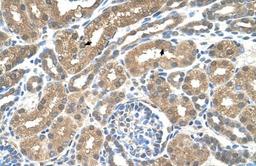 Immunohistochemistry-Paraffin: MCT3/SLC16A8 Antibody [NBP1-59885] - Human kidney Tissue, antibody concentration 4-8ug/ml. Cells with positive label: renal corpuscle cells (indicated with arrows) 400X magnification.