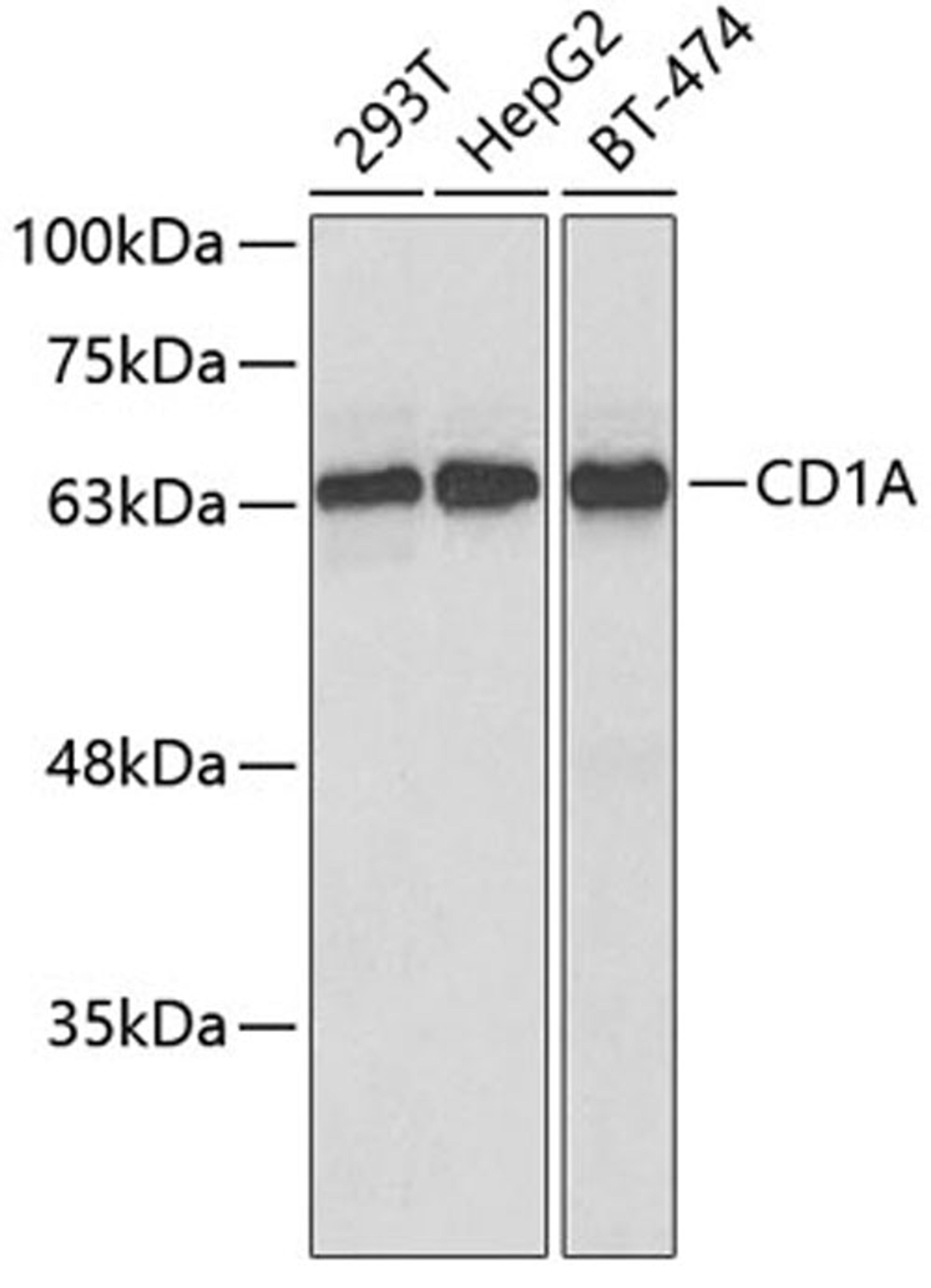 Western blot - CD1A antibody (A5722)