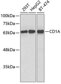 Western blot - CD1A antibody (A5722)
