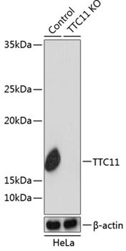 Western blot - TTC11 antibody (A19666)