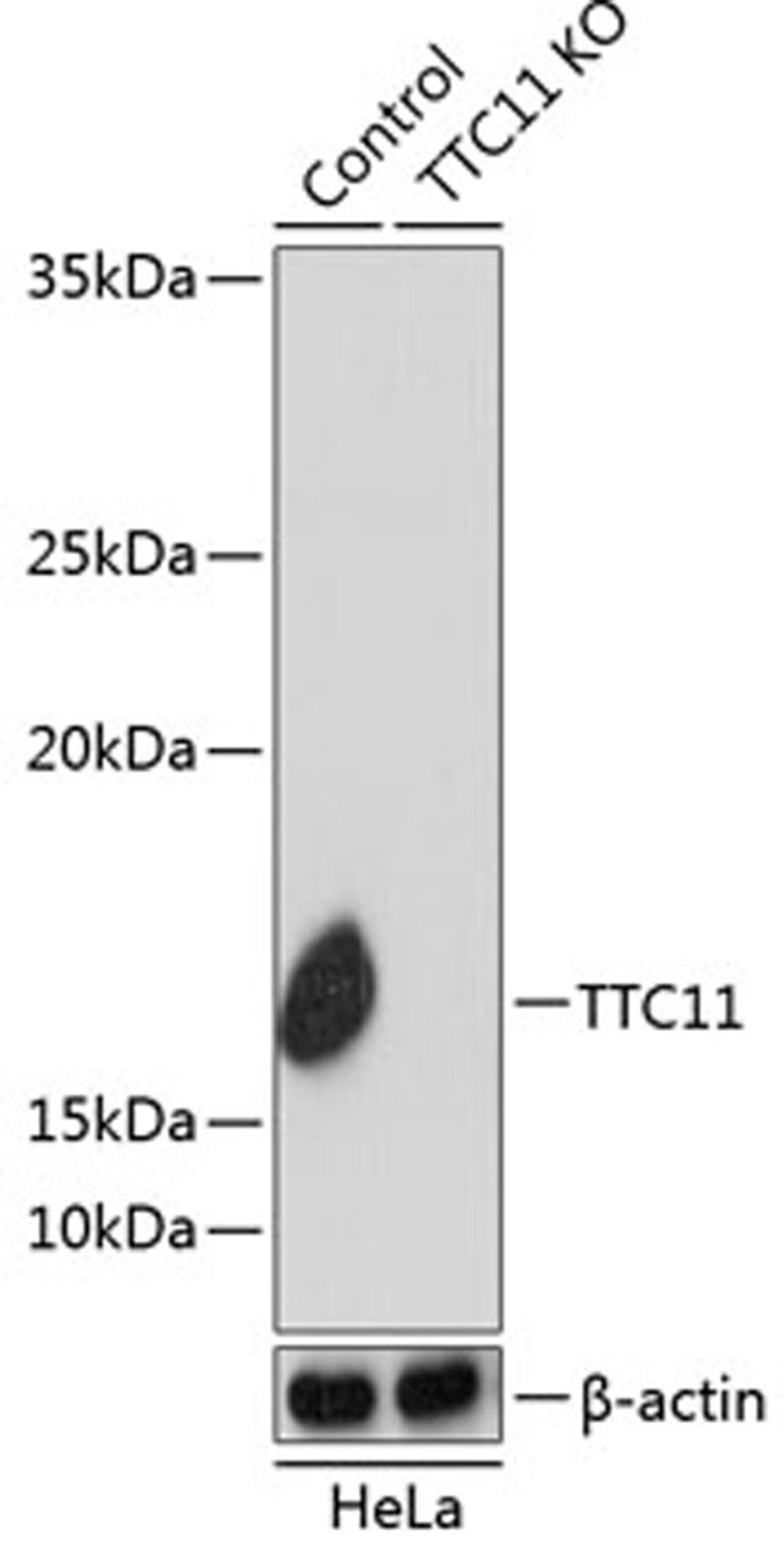 Western blot - TTC11 antibody (A19666)