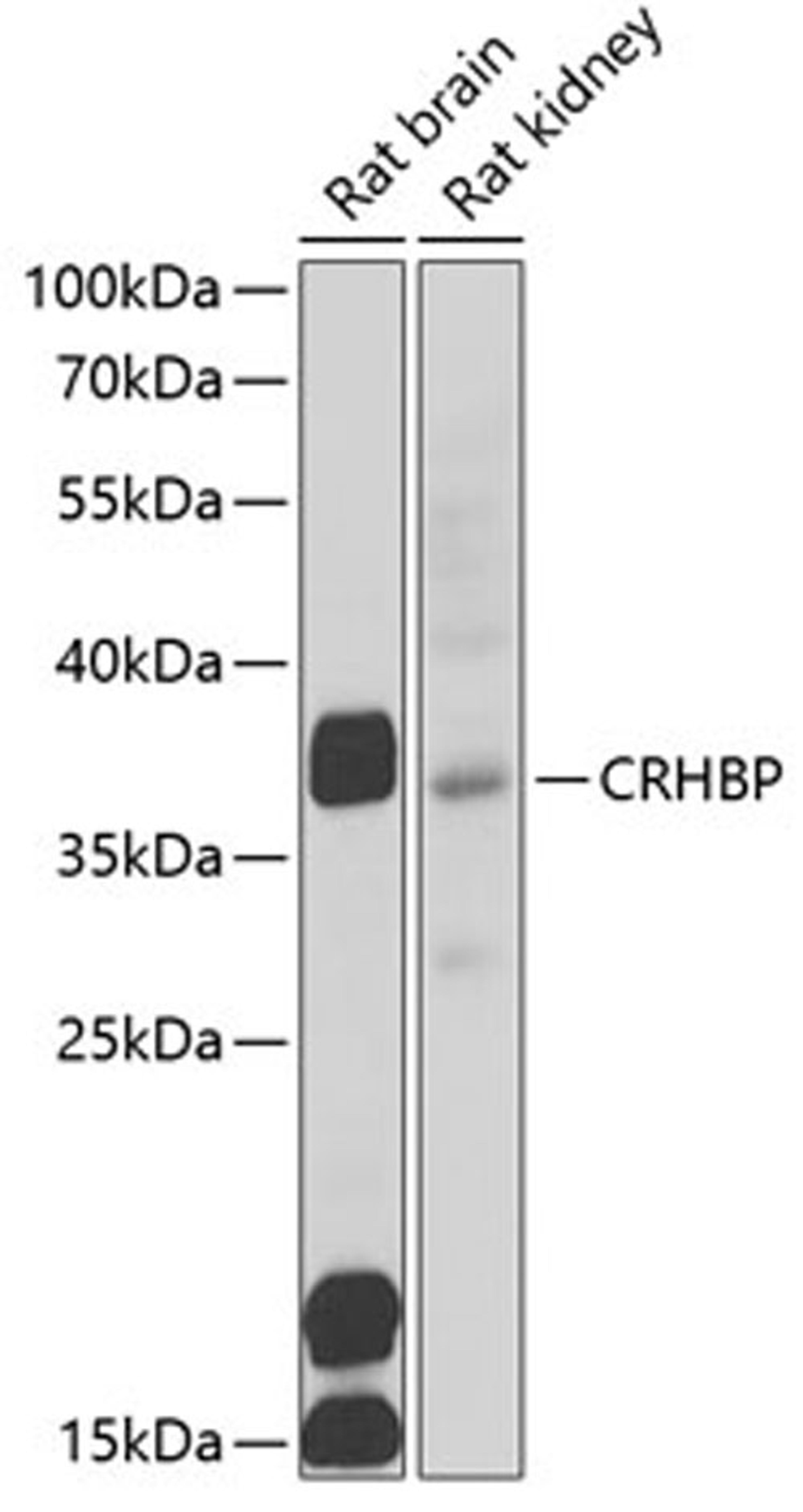 Western blot - CRHBP antibody (A6568)