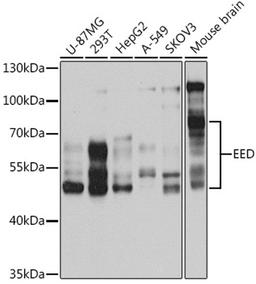 Western blot - EED antibody (A5371)