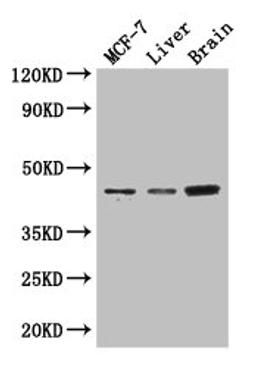 Western Blot. Positive WB detected in: MCF-7 whole cell lysate, Mouse liver tissue, Mouse brain tissue. All lanes: KCNJ11 antibody at 3µg/ml. Secondary. Goat polyclonal to rabbit IgG at 1/50000 dilution. Predicted band size: 44, 34 kDa. Observed band size: 44 kDa