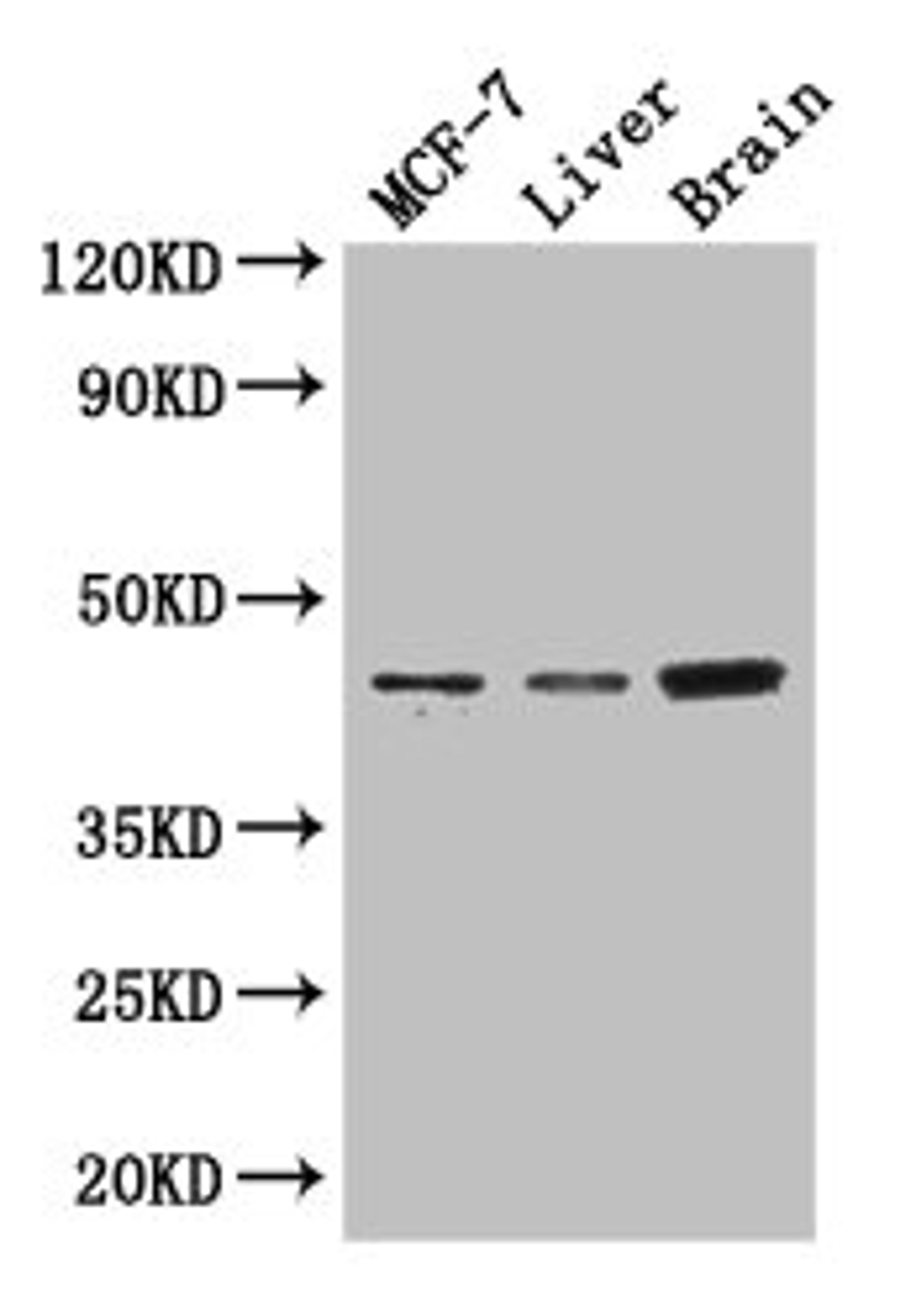 Western Blot. Positive WB detected in: MCF-7 whole cell lysate, Mouse liver tissue, Mouse brain tissue. All lanes: KCNJ11 antibody at 3µg/ml. Secondary. Goat polyclonal to rabbit IgG at 1/50000 dilution. Predicted band size: 44, 34 kDa. Observed band size: 44 kDa