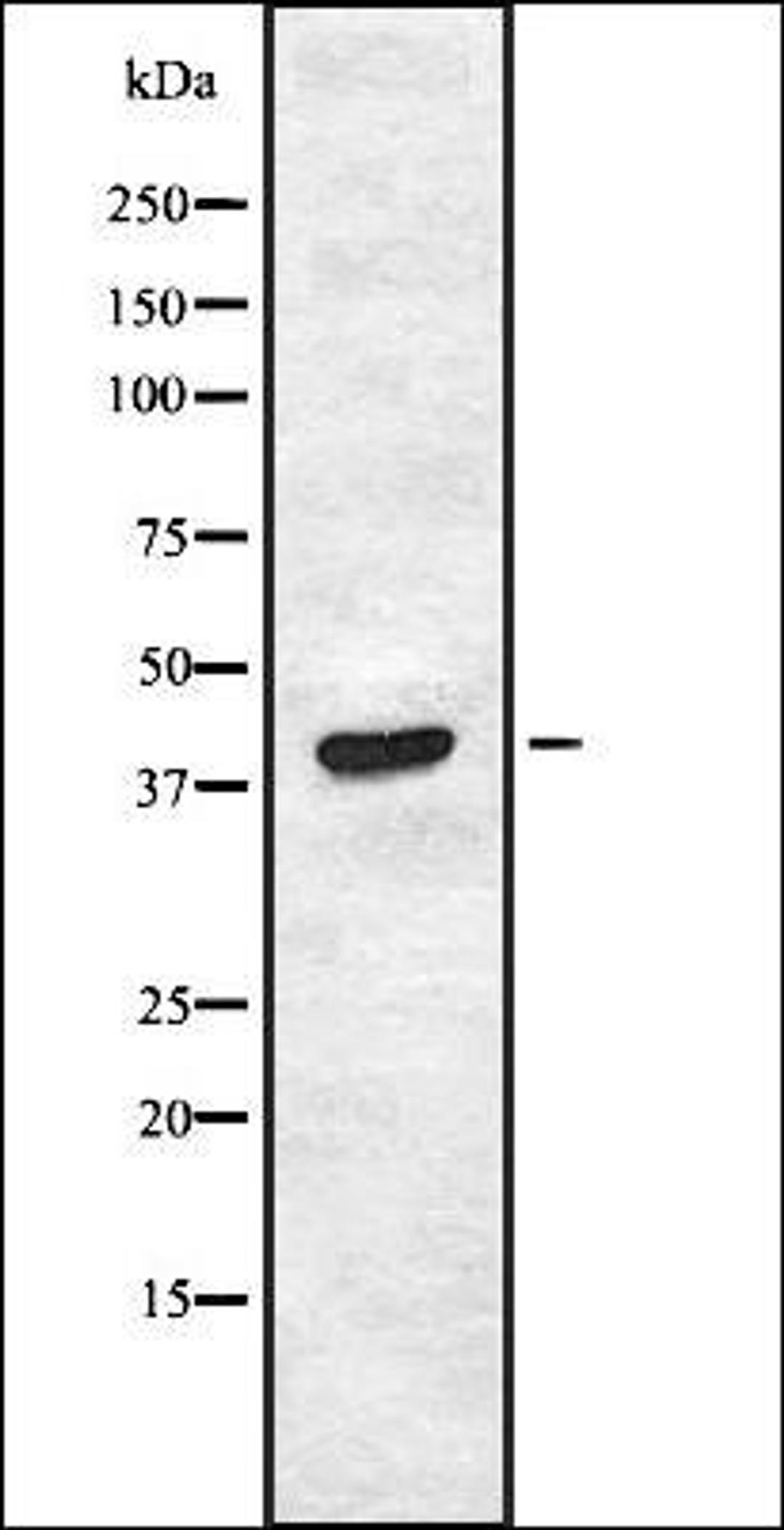 Western blot analysis of HEK293 cells using JAML1 antibody