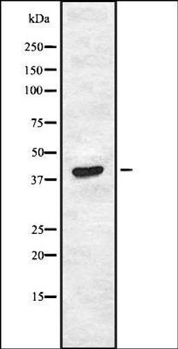 Western blot analysis of HEK293 cells using JAML1 antibody