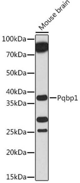 Western blot - Pqbp1 antibody (A18680)