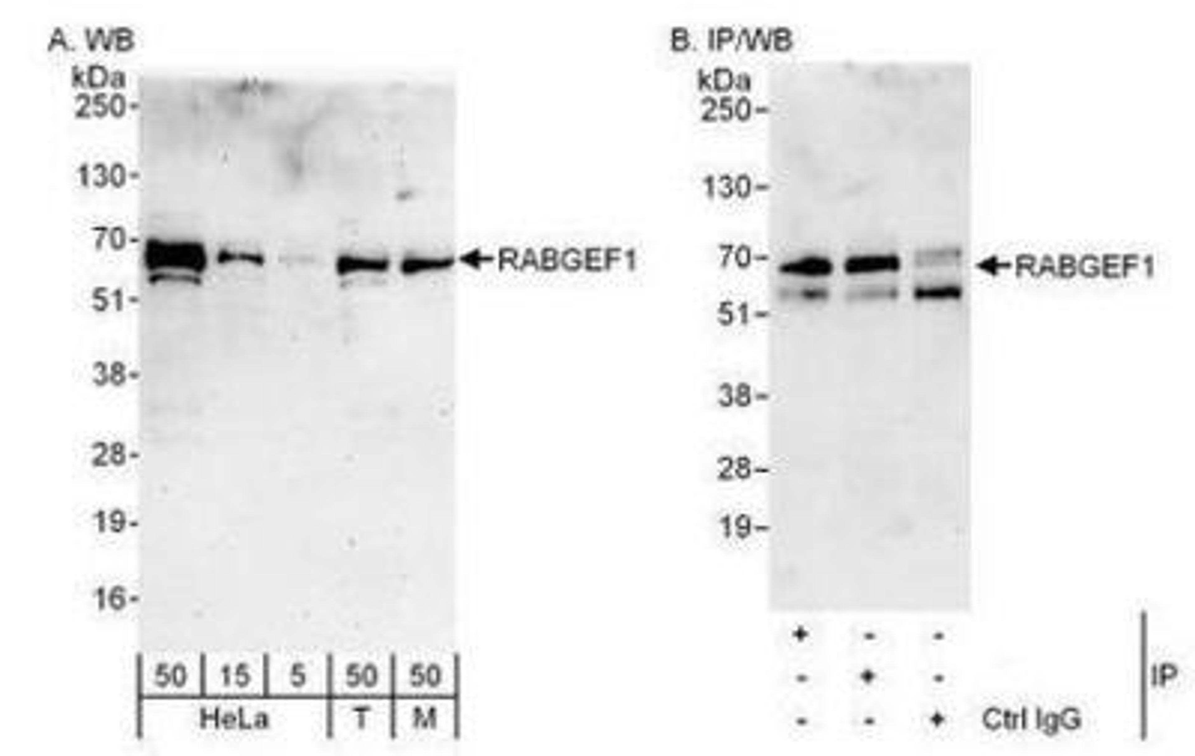 Western Blot: Rabex5 Antibody [NBP1-49938] - Detection of Human and Mouse RABGEF1 by Western Blot (h&m) and Immunoprecipitation (h).  Samples:  Whole cell lysate from HeLa (5, 15 and 50 mcg for WB; 1 mg for IP, 20% of IP loaded), 293T (T; 50 mcg) and mouse NIH3T3 (M; 50 mcg) cells.  Antibodies: Affinity purified rabbit anti-RABGEF1 antibody used for WB at 0.1 mcg/ml (A) and 1 mcg/ml (B) and used for IP at 3 mcg/mg lysate.  RABGEF1 was also immunoprecipitated by rabbit anti-RABGEF1 antibody which recognizes a downstream epitope.  For blotting immunoprecipitated RABGEF1 was used.   Detection: Chemiluminescence with exposure times of 3 minutes (A) and 30 seconds (B).