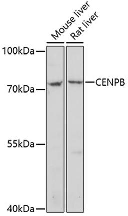 Western blot - CENPB antibody (A16817)