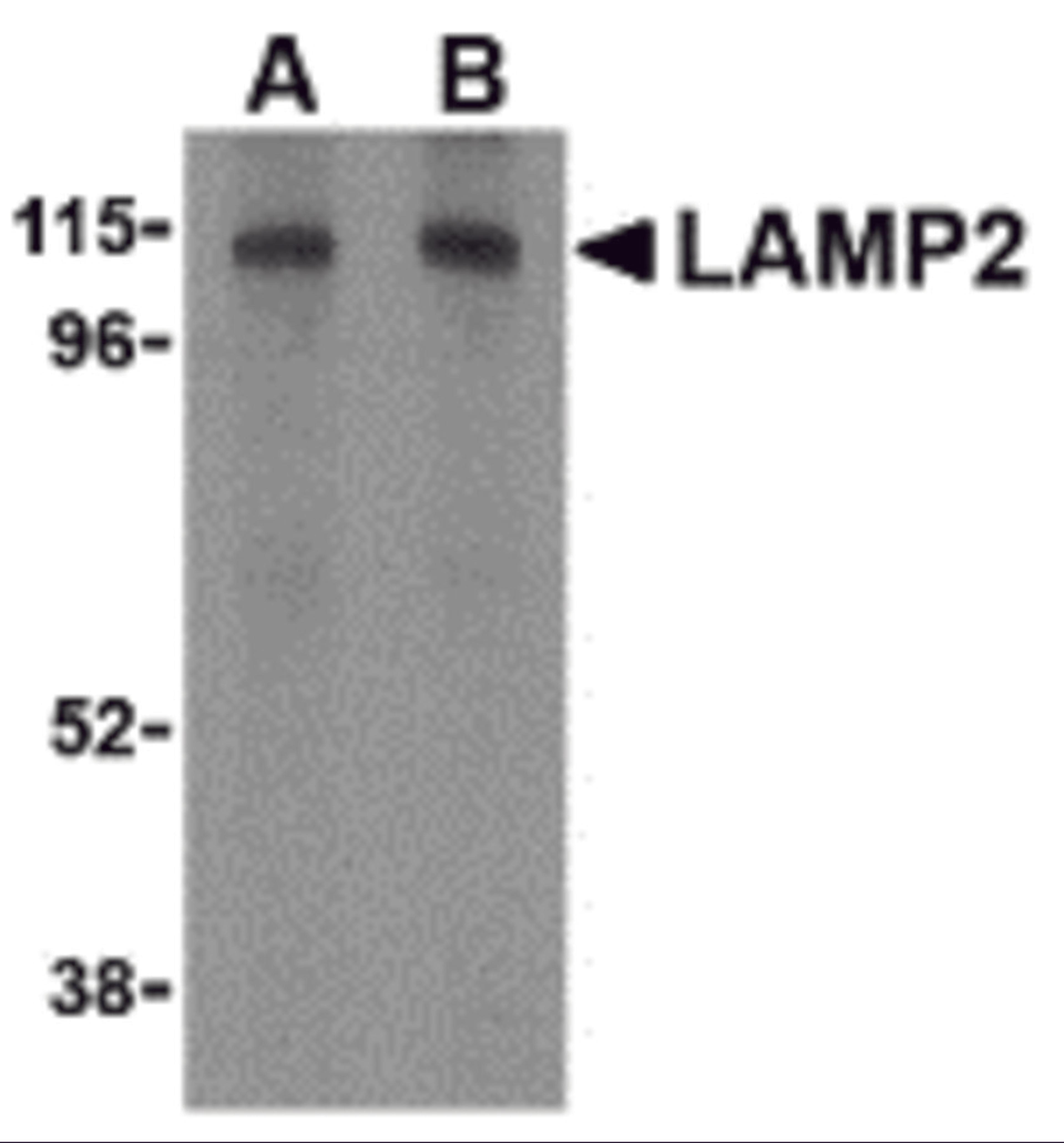 Western blot analysis of LAMP-2 in HepG2 cell lysate with LAMP-2 antibody at (A) 1 and (B) 2 μg/mL.