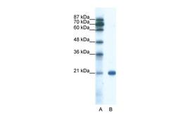 Antibody used in WB on Human Jurkat 0.2-1 ug/ml.