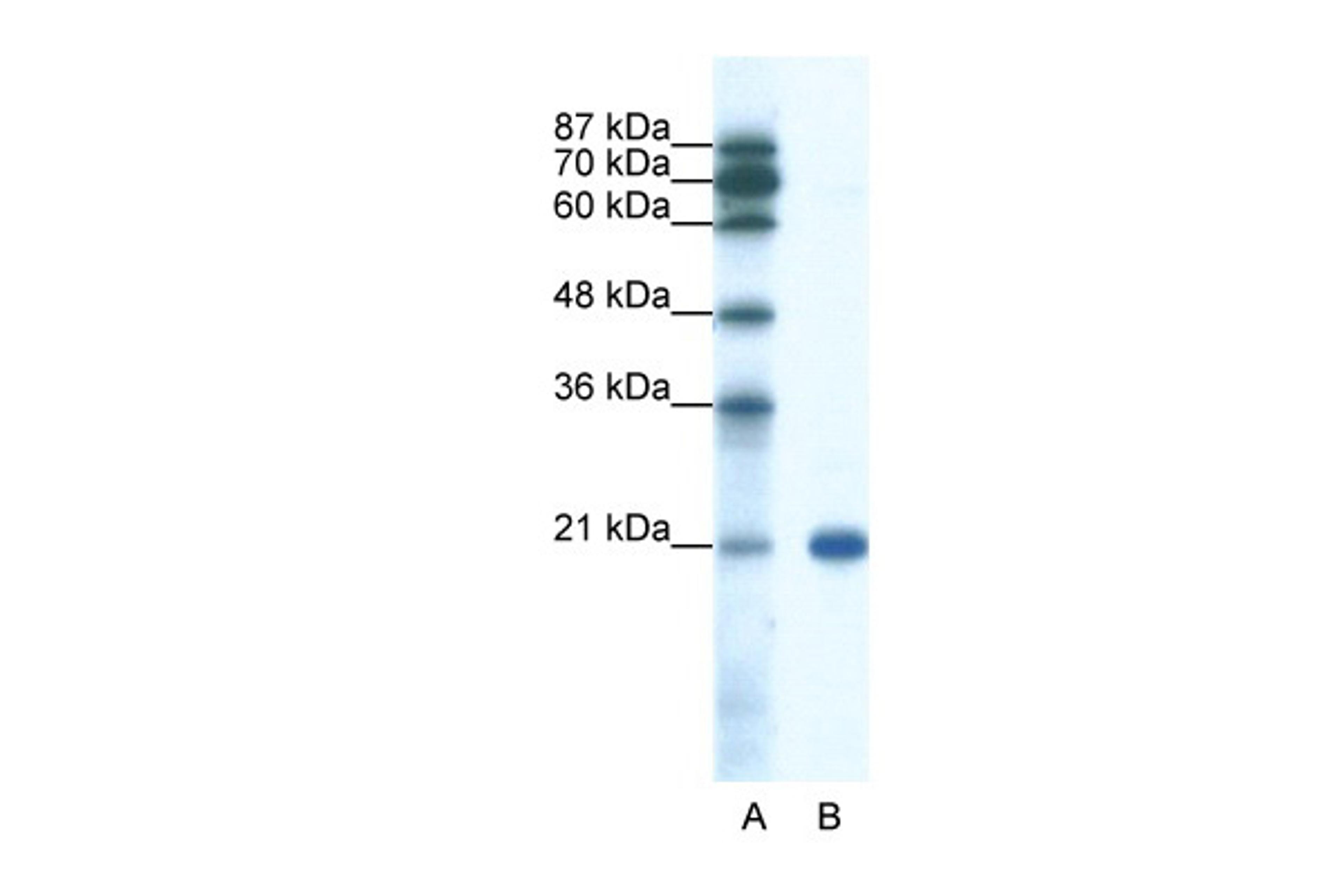 Antibody used in WB on Human Jurkat 0.2-1 ug/ml.