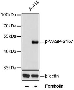 Western blot - Phospho-VASP-S157 antibody (AP0763)