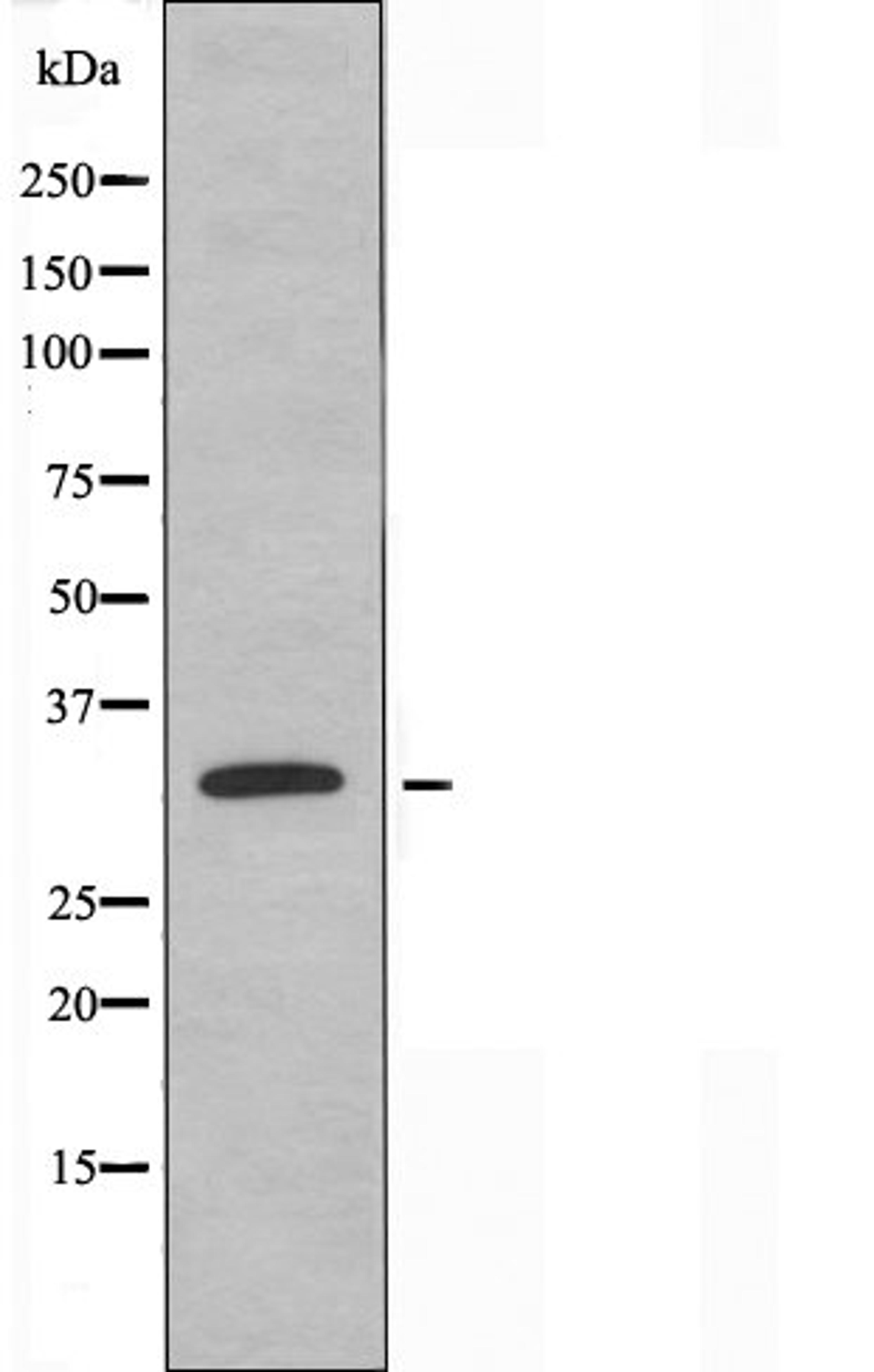 Western blot analysis of COLO cells using OR5H15 antibody