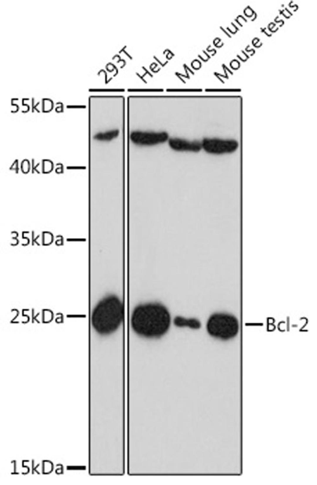 Western blot - Bcl-2 antibody (A16776)