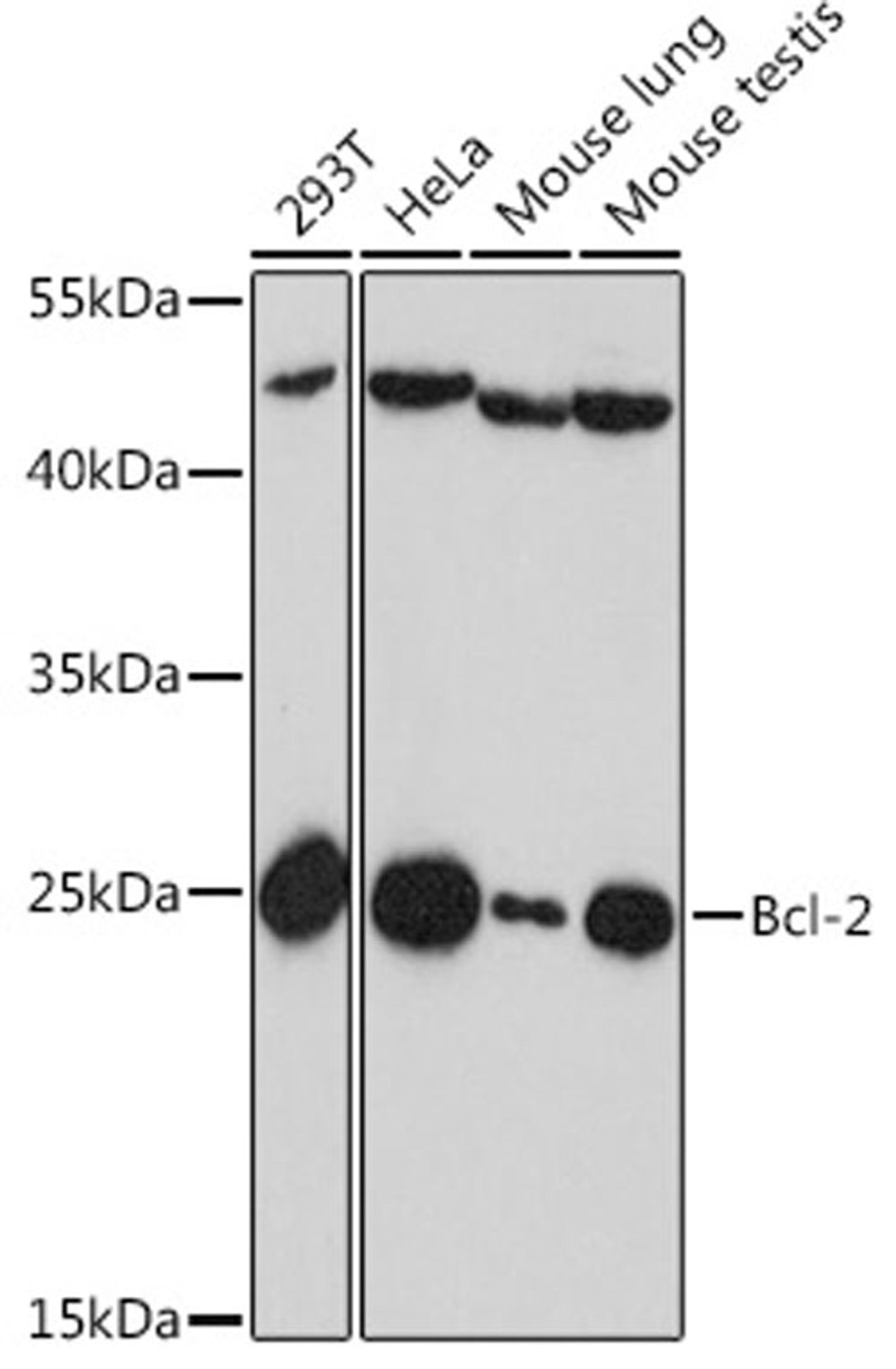 Western blot - Bcl-2 antibody (A16776)