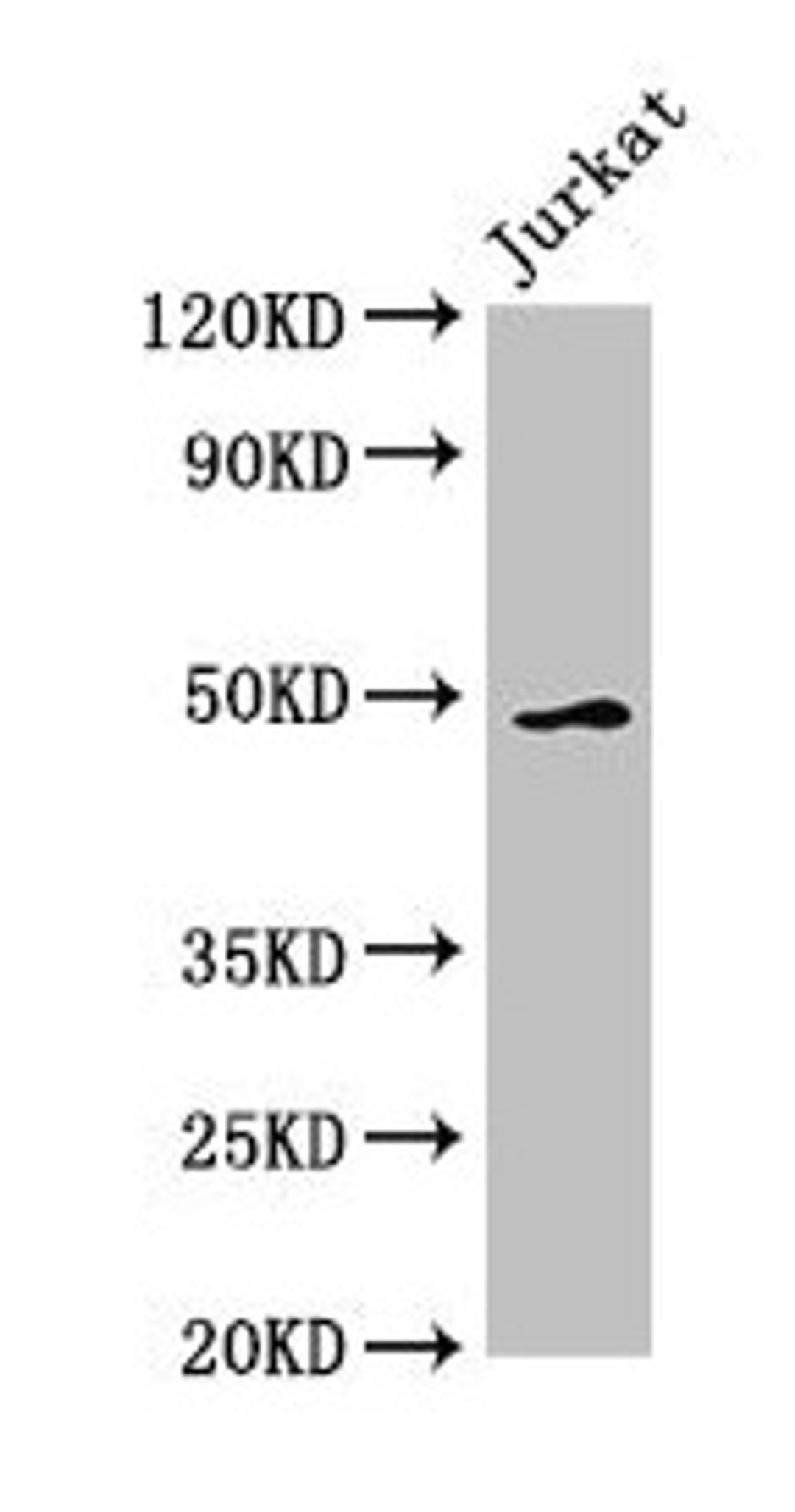 Western Blot. Positive WB detected in: Jurkat whole cell lysate. All lanes: GABPB2 antibody at 2.5µg/ml. Secondary. Goat polyclonal to rabbit IgG at 1/50000 dilution. Predicted band size: 49 kDa. Observed band size: 49 kDa