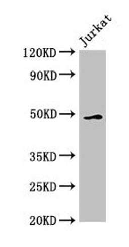 Western Blot. Positive WB detected in: Jurkat whole cell lysate. All lanes: GABPB2 antibody at 2.5µg/ml. Secondary. Goat polyclonal to rabbit IgG at 1/50000 dilution. Predicted band size: 49 kDa. Observed band size: 49 kDa