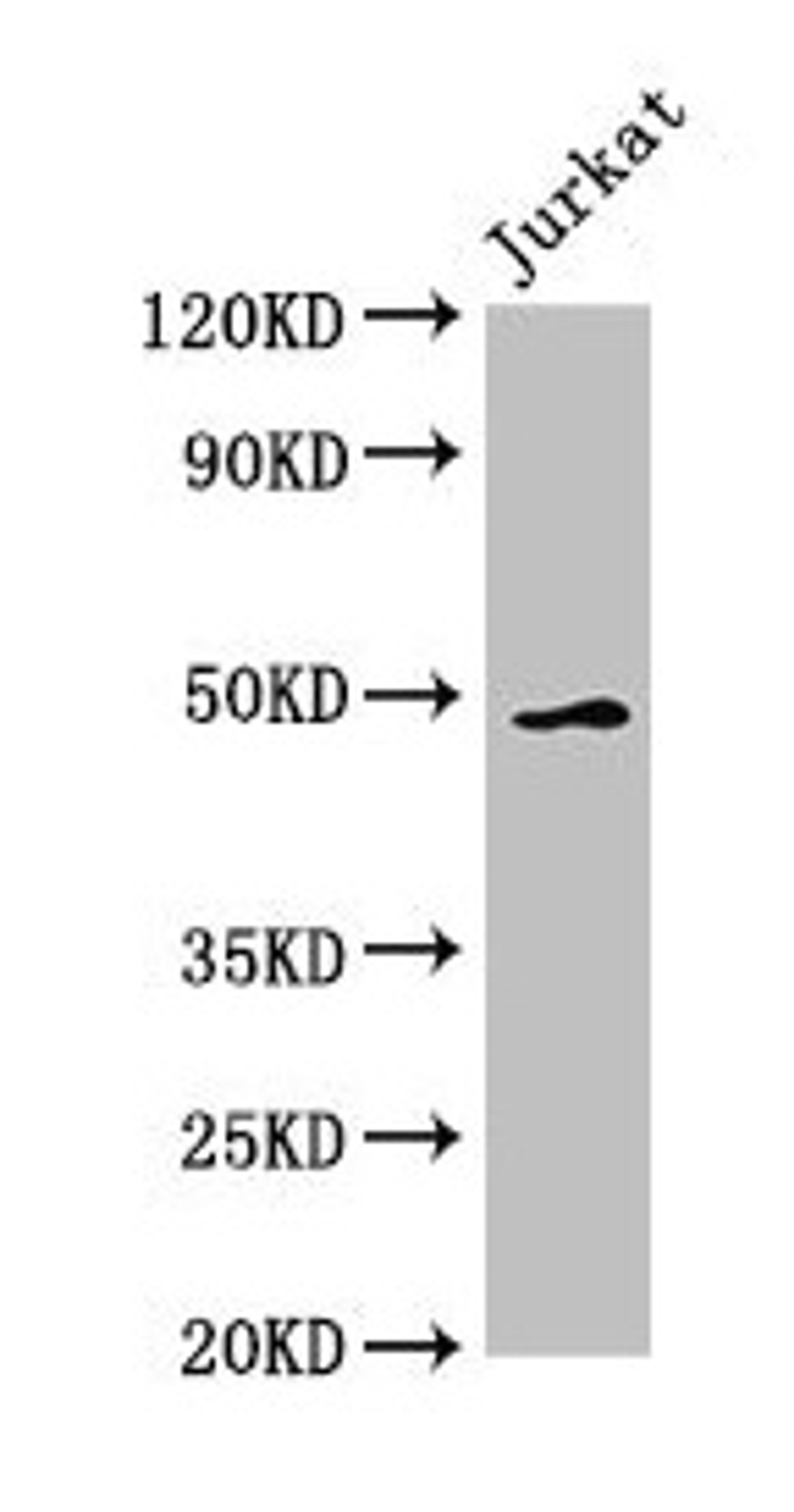 Western Blot. Positive WB detected in: Jurkat whole cell lysate. All lanes: GABPB2 antibody at 2.5µg/ml. Secondary. Goat polyclonal to rabbit IgG at 1/50000 dilution. Predicted band size: 49 kDa. Observed band size: 49 kDa