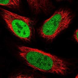 Immunocytochemistry/Immunofluorescence: Transketolase Antibody [NBP1-87441] - Staining of human cell line U-2 OS shows positivity in nucleus but not nucleoli.