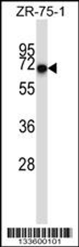 Western blot analysis in ZR-75-1 cell line lysates (35ug/lane).