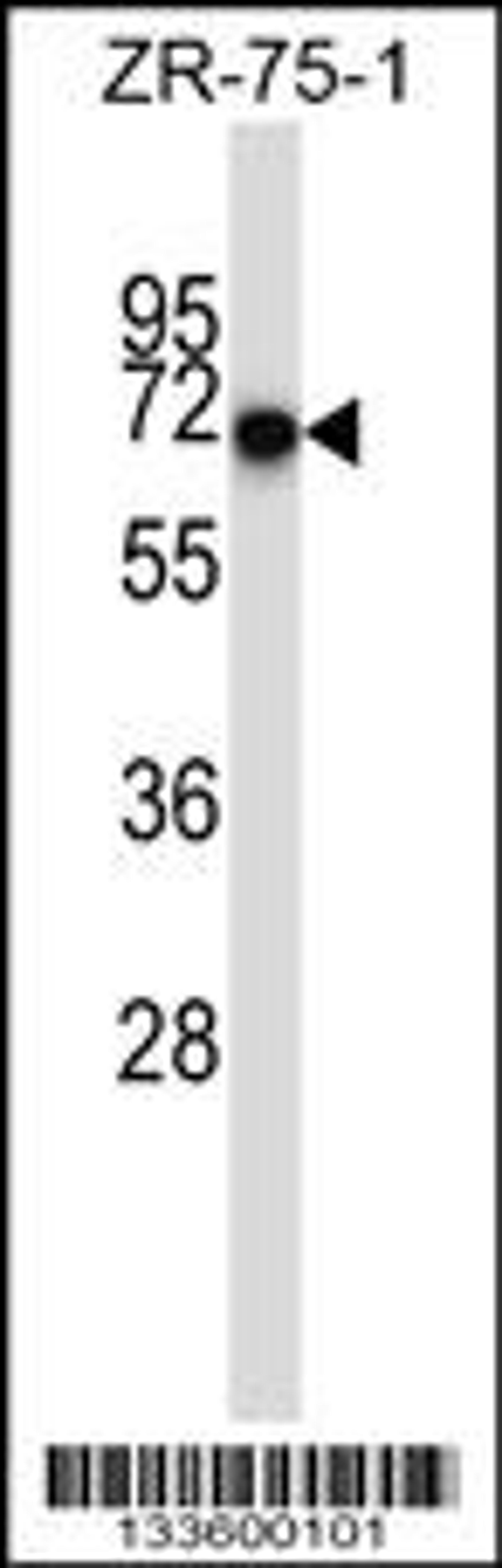 Western blot analysis in ZR-75-1 cell line lysates (35ug/lane).