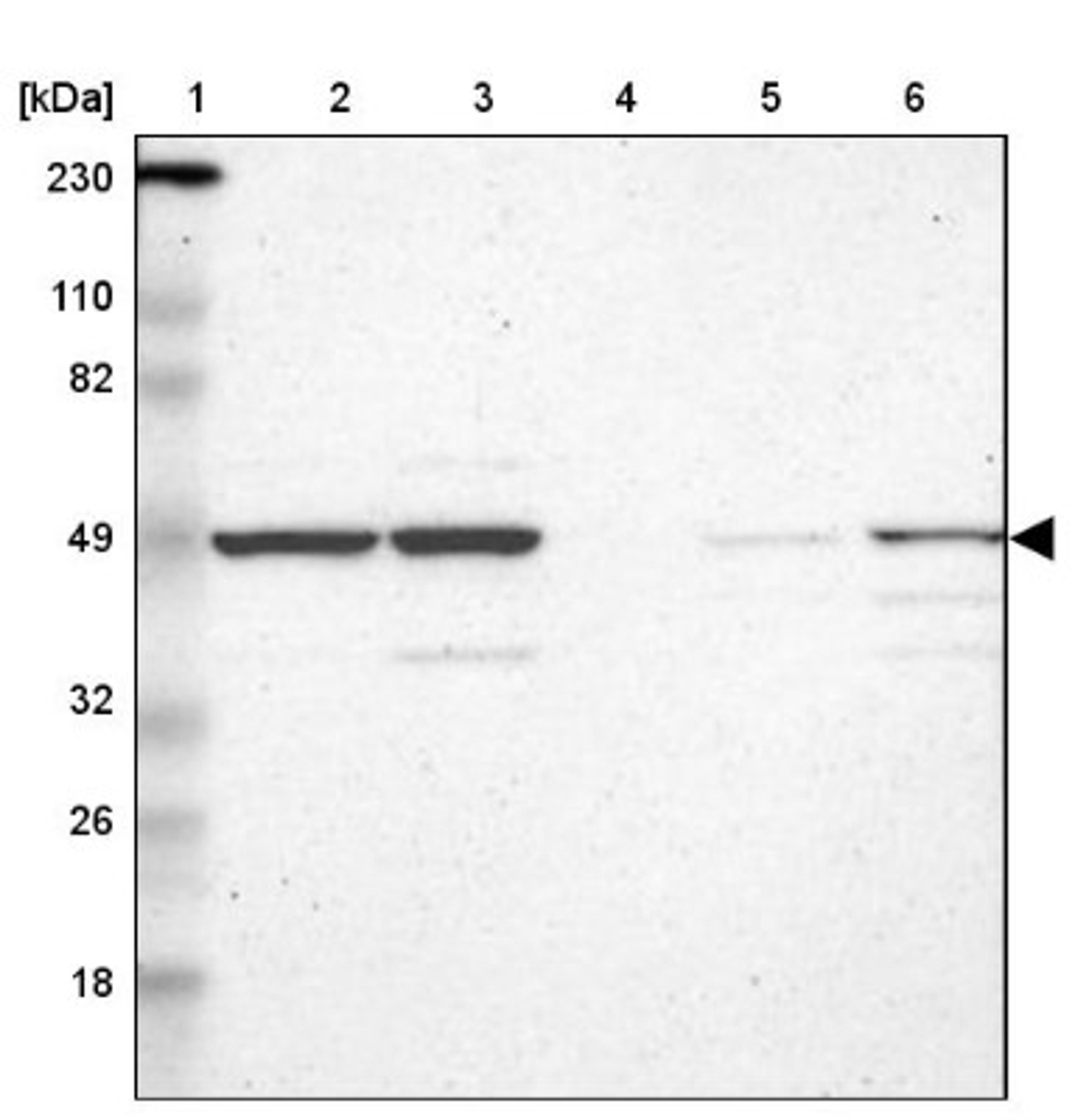 Western Blot: RBM22 Antibody [NBP1-85379] - Lane 1: Marker [kDa] 230, 110, 82, 49, 32, 26, 18<br/>Lane 2: Human cell line RT-4<br/>Lane 3: Human cell line U-251MG sp<br/>Lane 4: Human plasma (IgG/HSA depleted)<br/>Lane 5: Human liver tissue<br/>Lane 6: Human tonsil tissue