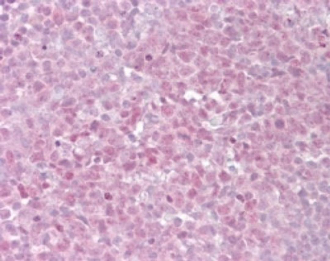 Immunohistochemistry-Paraffin: TRF2 Antibody [NB100-56694] - Analysis of Human Tonsil using TRF2 antibody at 15 ug/ml.