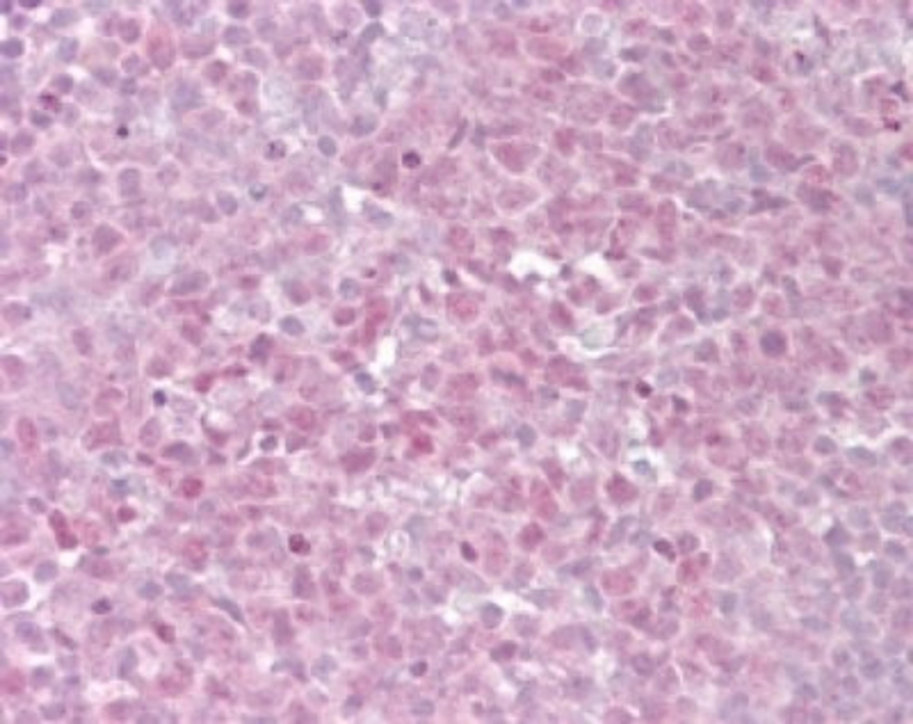 Immunohistochemistry-Paraffin: TRF2 Antibody [NB100-56694] - Analysis of Human Tonsil using TRF2 antibody at 15 ug/ml.