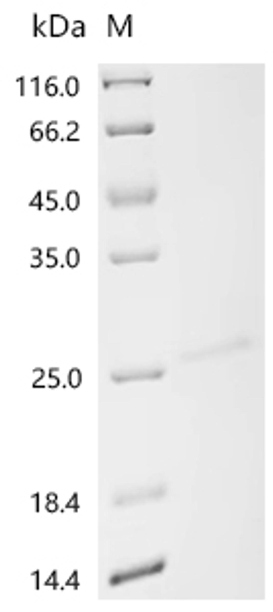 (Tris-Glycine gel) Discontinuous SDS-PAGE (reduced) with 5% enrichment gel and 15% separation gel.