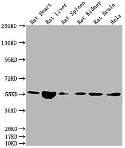 Western Blot. Positive WB detected in: Rat Heart tissue, Rat Liver tissue, Rat Spleen tissue, Rat Kidney tissue, Rat Brain tissue, Hela whole cell lysate. All lanes: Nampt antibody at 1:2000. Secondary. Goat polyclonal to rabbit IgG at 1/50000 dilution. Predicted band size: 56 kDa. Observed band size: 56 kDa. 