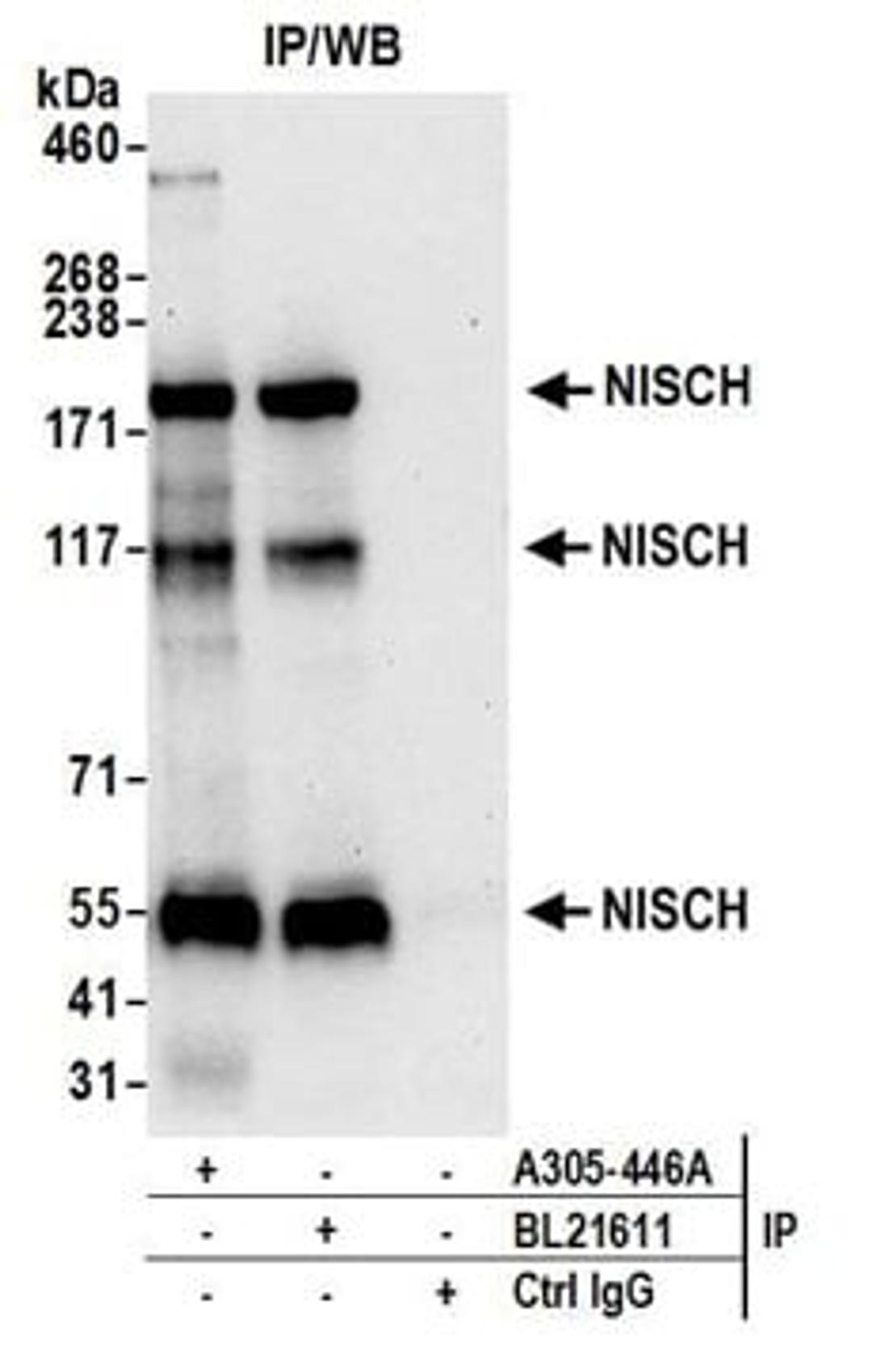 Detection of human NISCH by western blot of immunoprecipitates.