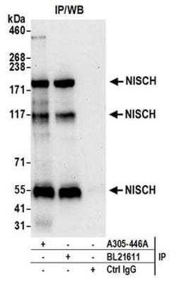 Detection of human NISCH by western blot of immunoprecipitates.