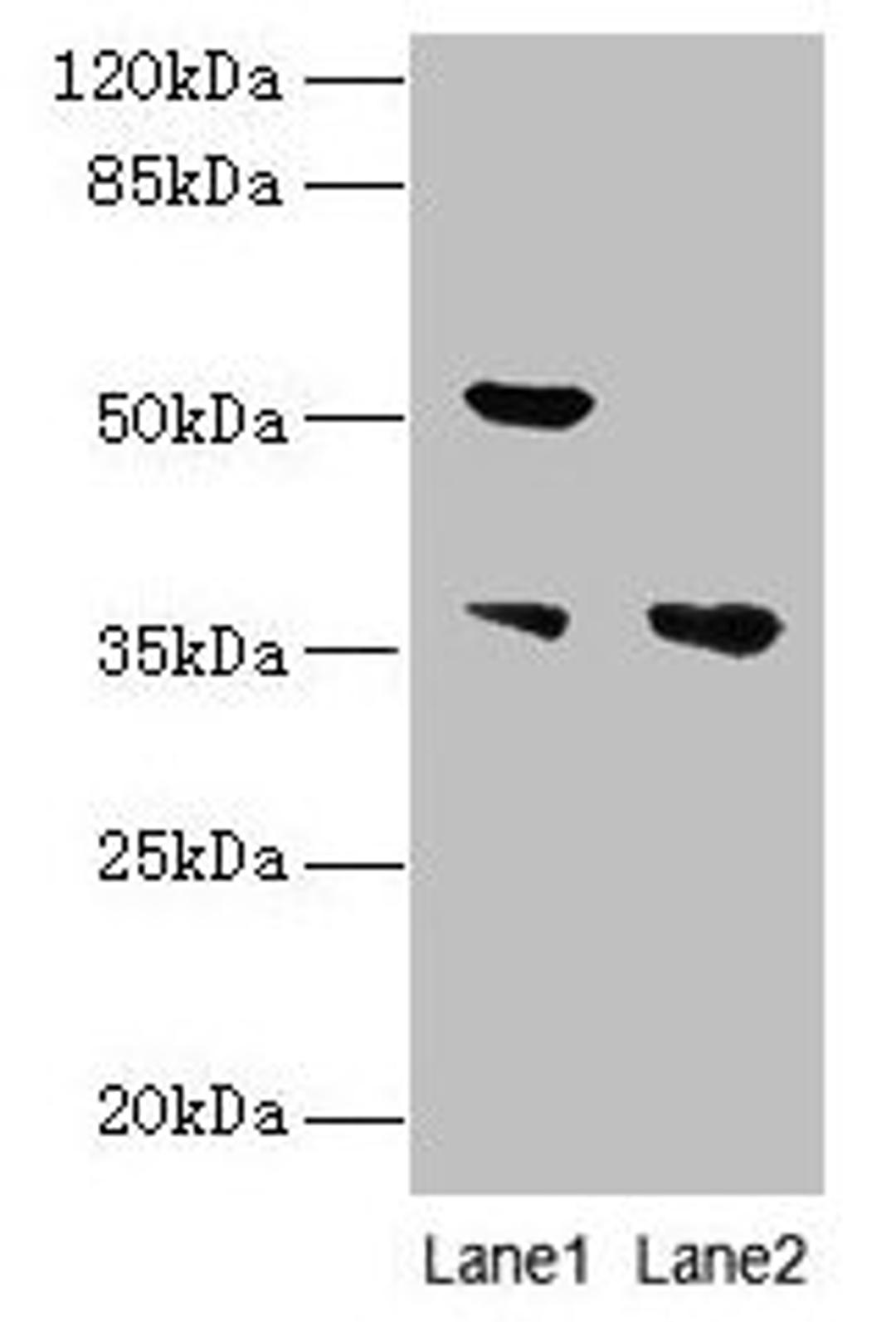 Western blot. All lanes: IMPACT antibody at 10µg/ml. Lane 1: Hela whole cell lysate. Lane 2: HL60 whole cell lysate. Secondary. Goat polyclonal to rabbit IgG at 1/10000 dilution. Predicted band size: 37, 23 kDa. Observed band size: 37, 52 kDa