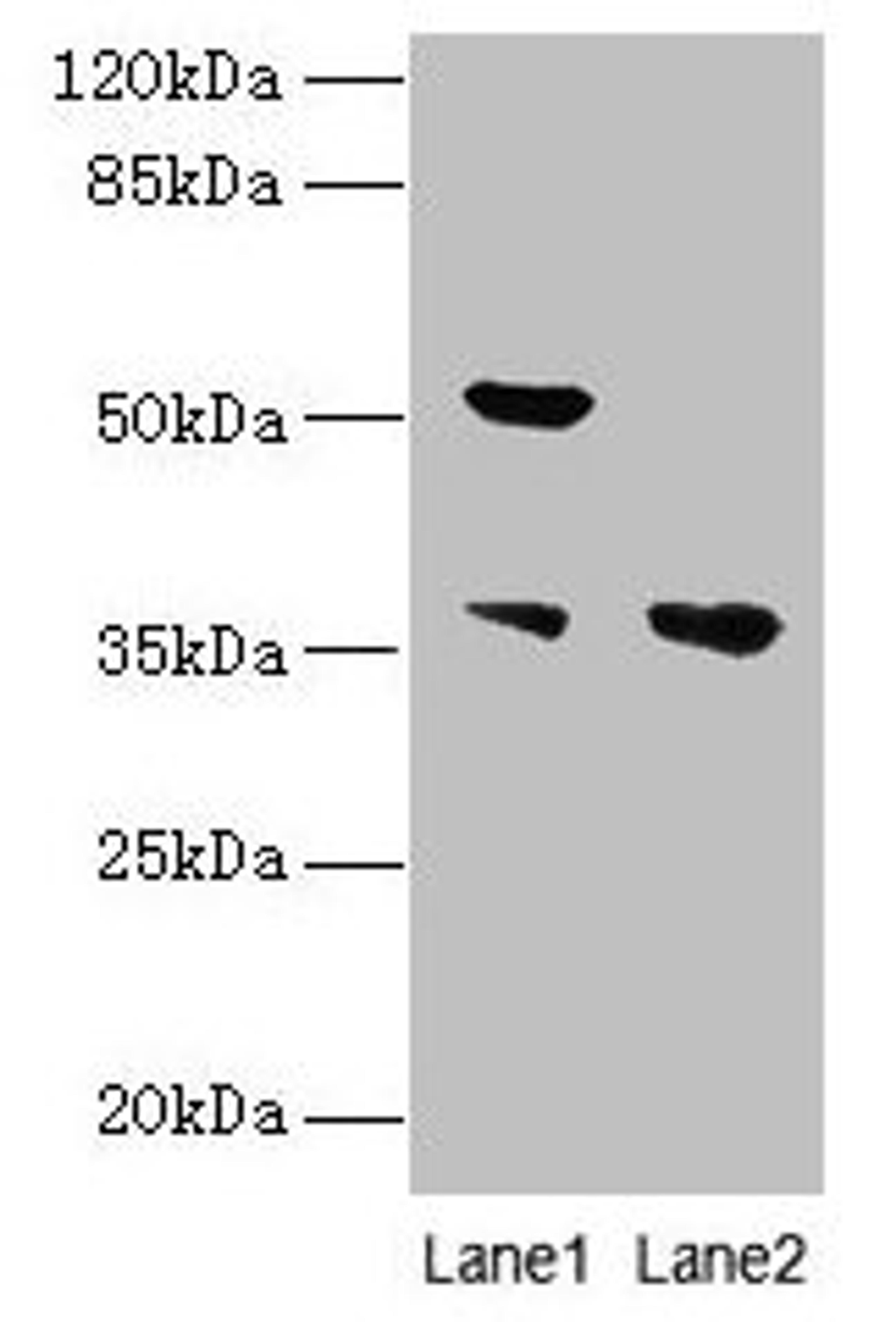 Western blot. All lanes: IMPACT antibody at 10µg/ml. Lane 1: Hela whole cell lysate. Lane 2: HL60 whole cell lysate. Secondary. Goat polyclonal to rabbit IgG at 1/10000 dilution. Predicted band size: 37, 23 kDa. Observed band size: 37, 52 kDa