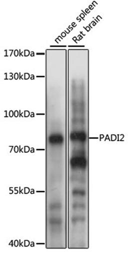 Western blot - PADI2 antibody (A11711)