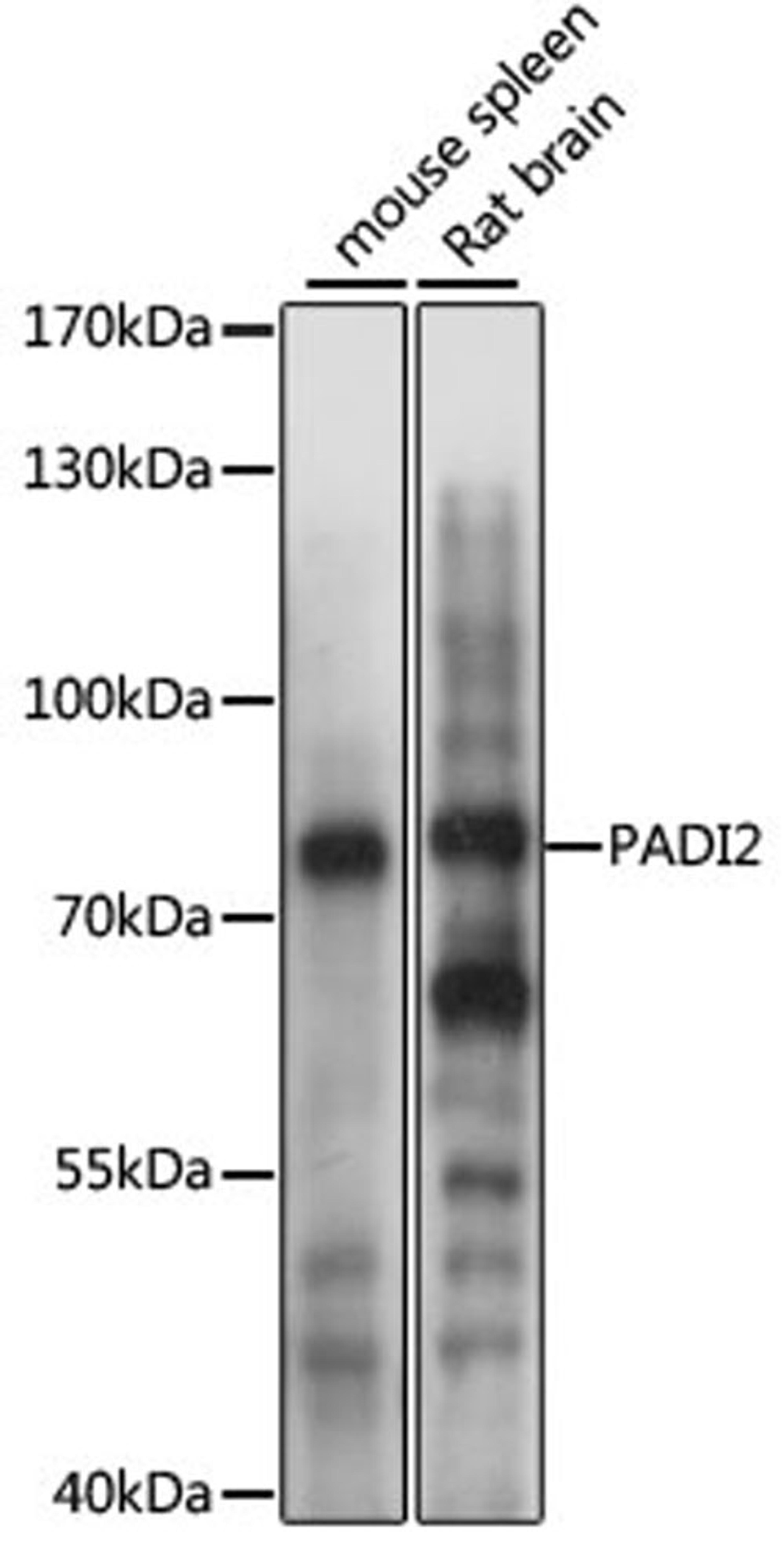 Western blot - PADI2 antibody (A11711)